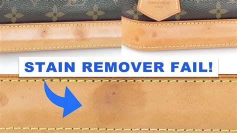 how to remove water marks on louis vuitton leather|louis vuitton vachetta stain remover.